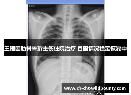 王刚因肋骨骨折重伤住院治疗 目前情况稳定恢复中